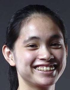 Joanne Ng